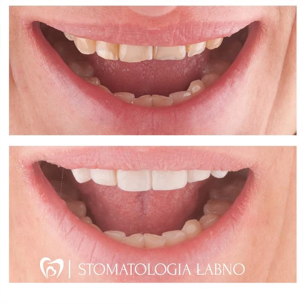 Stomatologia Łabno - aktualności